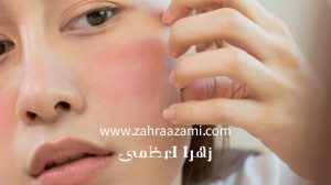 ضد آفتاب